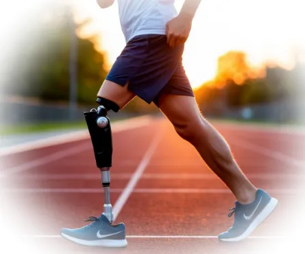 Жизнь после ампутации: как современные протезы возвращают мобильность