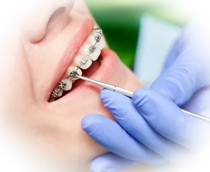 Путь к идеальной улыбке: всё об исправлении прикуса в Краснодаре — методы, цены и советы по выбору врача