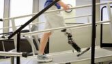Роботизированные протезы ног управляемые мыслью