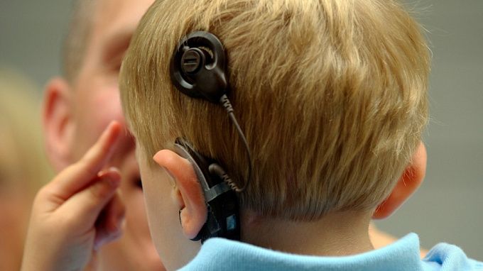Точка в бюрократической эпопее с компенсацией за имплант для глухого ребенка