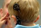 Точка в бюрократической эпопее с компенсацией за имплант для глухого ребенка